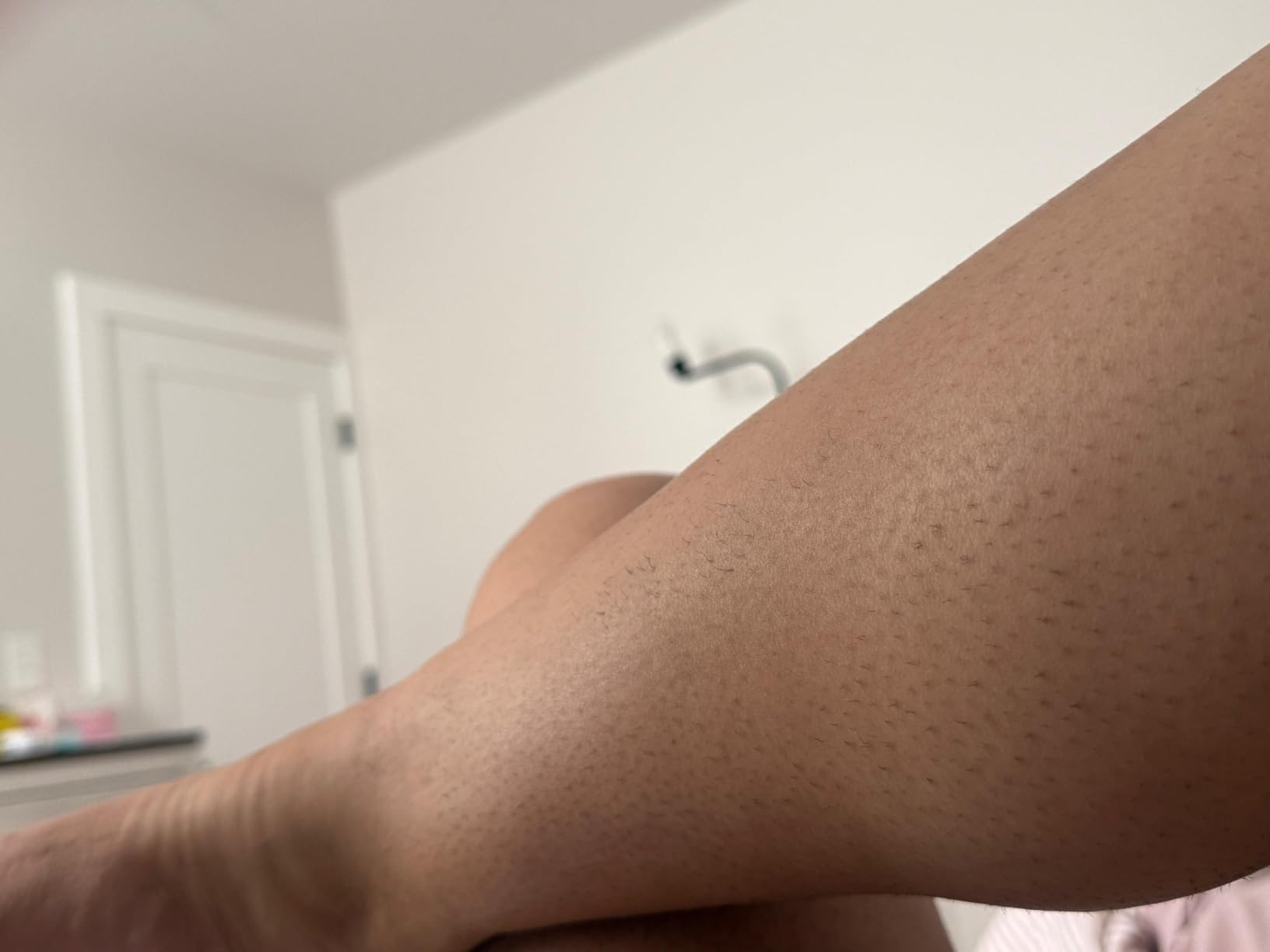 Philips Lumea IPL — Salon-Like Laser Hair Removal for Women, Permanent Hair Reduction Device At Home for Face & Body — Safe & Painless for Face, Bikini, Body, 5 Settings & Skin Sensors, BRI984/03 customer photo 1
